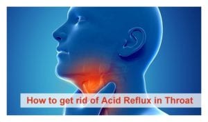 How to get rid of acid reflux in throat | Home remedies for acid reflux | acid reflux diet | how to get rid of acid reflux | How to relieve acid reflux | how to get rid of acid reflux in throat fast