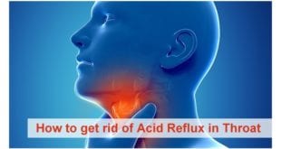 How to get rid of acid reflux in throat | Home remedies for acid reflux | acid reflux diet | how to get rid of acid reflux | How to relieve acid reflux | how to get rid of acid reflux in throat fast